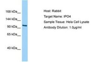 Image no. 1 for anti-Importin 4 (IPO4) (AA 468-517) antibody (ABIN6750201) (Importin 4 anticorps  (AA 468-517))