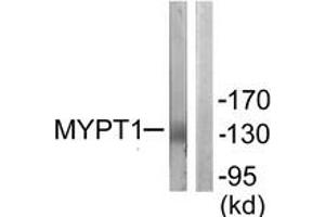 Western blot analysis of extracts from NIH-3T3 cells, using MYPT1 (Ab-853) Antibody. (PPP1R12A anticorps  (AA 621-670))