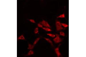 ABIN6274897 staining Hela cells by IF/ICC. (EPB41L2 anticorps  (Internal Region))