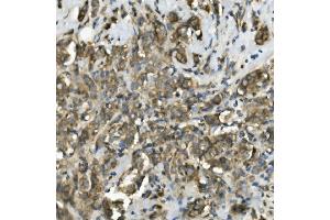 IHC analysis of TRIM25 using anti-TRIM25 antibody (ABIN7599495). (TRIM25 anticorps  (AA 1-610))
