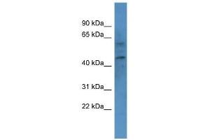 Western Blot showing CNR1 antibody used at a concentration of 1.