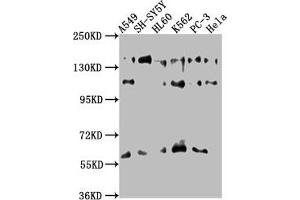 Western Blot Positive WB detected in: A549 whole cell lysate, SH-SY5Y whole cell lysate, HL60 whole cell lysate, K562 whole cell lysate, PC-3 whole cell lysate, Hela whole cell lysate All lanes: SOS2 antibody at 1:1000 Secondary Goat polyclonal to rabbit IgG at 1/50000 dilution Predicted band size: 153, 150 kDa Observed band size: 153 kDa (SOS2 anticorps  (AA 187-404))