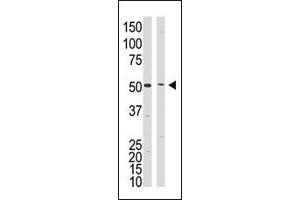 Western Blotting (WB) image for anti-Presenilin 1 (PSEN1) (C-Term) antibody (ABIN358721) (Presenilin 1 anticorps  (C-Term))