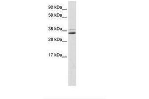 Image no. 1 for anti-Secreted Frizzled-Related Protein 1 (SFRP1) (C-Term) antibody (ABIN202220) (SFRP1 anticorps  (C-Term))
