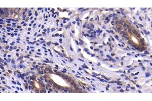 Detection of CASP9 in Rat Uterus Tissue using Polyclonal Antibody to Caspase 9 (CASP9)
