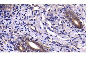Detection of CASP9 in Rat Uterus Tissue using Polyclonal Antibody to Caspase 9 (CASP9) (Caspase 9 anticorps  (AA 1-200))