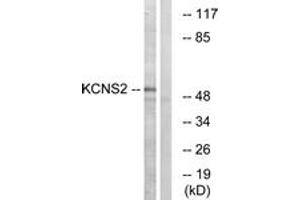 Western blot analysis of extracts from HepG2 cells, using KCNS2 Antibody. (KCNS2 anticorps  (AA 197-246))
