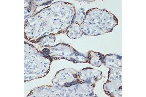 Immunohistochemistry of paraffin-embedded human placenta using HSD3B1 Rabbit mAb (ABIN7267801) at dilution of 1:100 (40x lens).