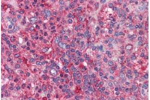 Human Spleen: Formalin-Fixed, Paraffin-Embedded (FFPE) (BIRC3 anticorps  (AA 314-508))