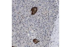 Immunohistochemical staining of human pancreas with ZDHHC15 polyclonal antibody  shows strong cytoplasmic positivity in islet cells. (ZDHHC15 anticorps)