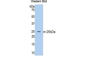 Western blot analysis of the recombinant protein. (PIK3CB anticorps  (AA 524-703))