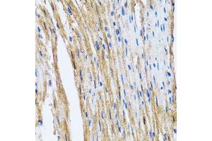 Immunohistochemistry of paraffin-embedded mouse heart using GOLM1 antibody.