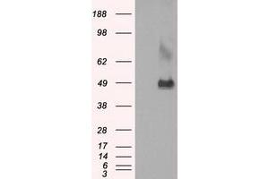 Western Blotting (WB) image for anti-Lysyl Oxidase (LOX) (AA 22-168) antibody (ABIN1491216)
