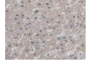 IHC-P analysis of Human Liver Tissue, with DAB staining. (Antizyme Inhibitor 1 anticorps  (Lys290))