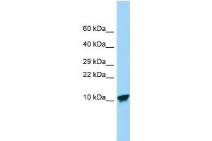 Host: Rabbit Target Name: SPINK9 Sample Type: Placenta lysates Antibody Dilution: 1.