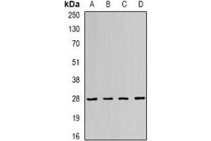 Western blot analysis of RAB11A expression in Jurkat (A), SHSY5Y (B), PC12 (C), mouse spleen (D) whole cell lysates. (RAB11A anticorps)