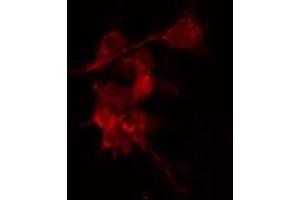 ABIN6274202 staining Hela cells by IF/ICC. (PRKACB anticorps  (C-Term))