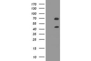 Image no. 1 for anti-tRNA Methyltransferase 2 Homolog A (TRMT2A) antibody (ABIN1501521) (TRMT2A anticorps)