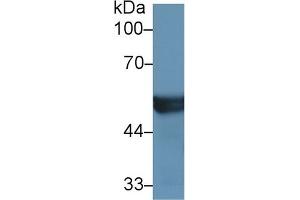 Detection of CYP2D6 in Mouse Liver lysate using Polyclonal Antibody to Cytochrome P450 2D6 (CYP2D6)
