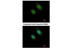 ICC/IF Image Immunofluorescence analysis of methanol-fixed HeLa, using CaMK1D, antibody at 1:500 dilution. (CAMK1D anticorps)