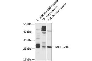 Western blot analysis of extracts of various cell lines, using METTL21C antibody (ABIN6131461, ABIN6143763, ABIN6143764 and ABIN6214649) at 1:1000 dilution. (METTL21C anticorps  (AA 1-264))