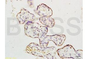 Formalin-fixed and paraffin embedded human placenta labeled with Rabbit Anti ERK1/MAPK3 Polyclonal Antibody, Unconjugated (ABIN736476) at 1:200 followed by conjugation to the secondary antibody and DAB staining