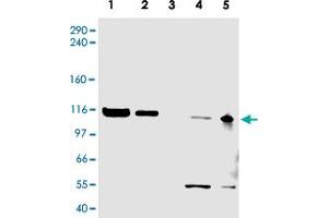 Western blot using ATAD5 polyclonal antibody  shows detection of a band ~120 KDa corresponding to human ATAD5 (arrowhead) in various cell lysates. (ATAD5 anticorps  (AA 63-76))