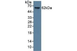 Detection of CK9 in Human Lung Tissue using Monoclonal Antibody to Cytokeratin 9 (CK9)