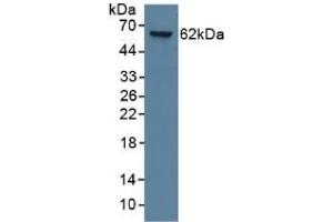 Detection of CK9 in Human Lung Tissue using Monoclonal Antibody to Cytokeratin 9 (CK9) (KRT9 anticorps  (AA 315-456))