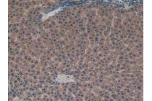 IHC-P analysis of Rat Liver Tissue, with DAB staining. (FGFRL1 anticorps  (AA 164-368))