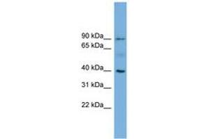 Image no. 1 for anti-Hemochromatosis (HFE) (AA 35-84) antibody (ABIN6744769) (HFE anticorps  (AA 35-84))
