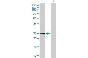 Western Blot analysis of FKBP7 expression in transfected 293T cell line by FKBP7 MaxPab polyclonal antibody.