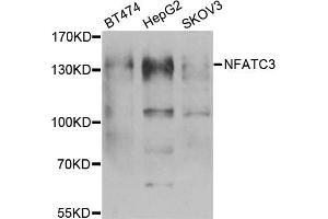 Western blot analysis of extracts of various cell lines, using NFATC3 antibody (ABIN5974017) at 1/1000 dilution. (NFATC3 anticorps)
