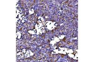 anti-Dihydrolipoamide S-Succinyltransferase (E2 Component of 2-Oxo-Glutarate Complex) (DLST) (AA 1-453) antibody