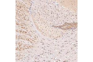 IHC analysis of SGCE using anti-SGCE antibody (ABIN7601544). (SGCE anticorps  (AA 38-407))