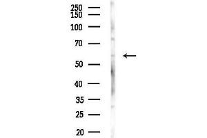 Western blot analysis of lysates from Mouse liver, using Phospho-STK39 (Ser311) Antibody at 1/1000 dilution.