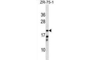 Western Blotting (WB) image for anti-Carbonyl Reductase 4 (CBR4) antibody (ABIN5019097) (CBR4 anticorps)