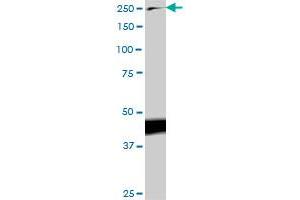 TLN1 monoclonal antibody (M03), clone 1A11.