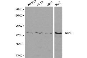 Western blot analysis of extracts of various cell lines, using IKBKB antibody (ABIN5971113) at 1/500 dilution. (IKBKB anticorps)
