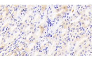 Detection of LAMb1 in Mouse Kidney Tissue using Polyclonal Antibody to Laminin Beta 1 (LAMb1)