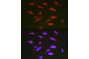 Immunofluorescence analysis of U2OS cells using Phospho-c-Jun-T91 Rabbit pAb (ABIN7268058) at dilution of 1:50 (40x lens). (C-JUN anticorps  (pThr91))