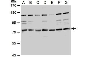 WB Image TACC2 antibody detects TACC2 protein by western blot analysis.