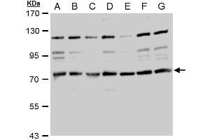 WB Image TACC2 antibody detects TACC2 protein by western blot analysis. (TACC2 anticorps  (N-Term))