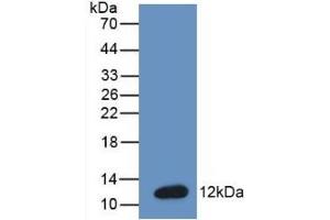 Detection of Recombinant BNP, Mouse using Monoclonal Antibody to Brain Natriuretic Peptide (BNP) (BNP anticorps  (AA 77-121))