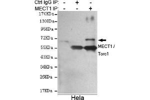 Immunoprecipitation analysis of Hela cell lysate using MECT1 / Torc1 mouse mAb. (CRTC1 anticorps)