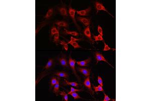 Immunofluorescence analysis of C6 cells using Rac1/2/3 Rabbit pAb (ABIN6129317, ABIN6146616, ABIN6146618 and ABIN6223653) at dilution of 1:100 (40x lens).
