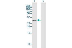 Western Blot analysis of TNFRSF13C expression in transfected 293T cell line by TNFRSF13C MaxPab polyclonal antibody.