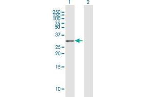 Western Blot analysis of TNFRSF13C expression in transfected 293T cell line by TNFRSF13C MaxPab polyclonal antibody. (TNFRSF13C anticorps  (AA 1-184))