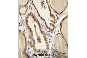 GUCY2D Antibody (Center) (ABIN655516 and ABIN2845031) immunohistochemistry analysis in formalin fixed and paraffin embedded human thyroid tissue followed by peroxidase conjugation of the secondary antibody and DAB staining.