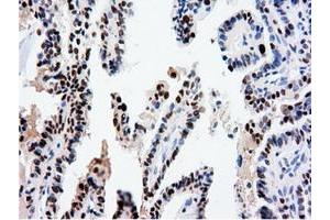 Image no. 12 for anti-5'-Nucleotidase Domain Containing 1 (NT5DC1) antibody (ABIN1499838)